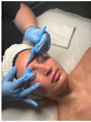 AlumierMD skin care near me Griffin Georgia, LifeViz® 360 skin care near me Griffin Georgia, Dermaplane Services skin care Griffin GA, Griffin Georgia, Signature Facial and Custom Facial Griffin GA, HydraFusion Boost - LED Therapy - Oxygen Infusion - Collagen Renewal Mask - PDRN (Salmon DNA) Repair Add-On Griffin GA, Youth Plasma Upgrade Griffin GA, Georgia Wellness Solutions, Dr. Vu Med Spa Solutions Facial skin care, facial skin care near me Griffin Ga, Dermaplane Services skin care near me Griffin GA,